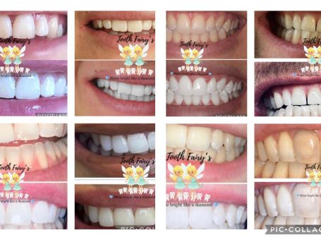 Tooth Fairy’s  – Teeth whitening specialists